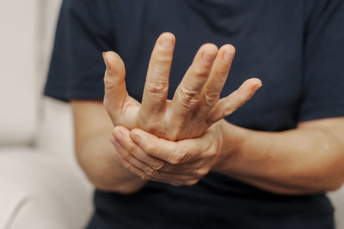 CID Síndrome do Túnel do Carpo dá direito a aposentadoria?